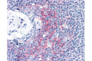 Anti-ICAM-1 antibody IHC of human spleen. (ICAM1 antibody)