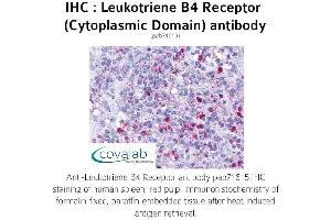 Image no. 1 for anti-Leukotriene B4 Receptor (LTB4R) (3rd Cytoplasmic Domain) antibody (ABIN1736422)