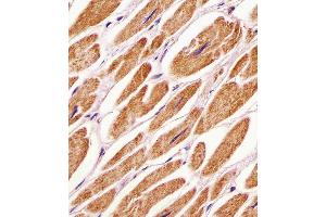 (ABIN391039 and ABIN2841206) staining PDK4 in human heart tissue sections by Immunohistochemistry (IHC-P - paraformaldehyde-fixed, paraffin-embedded sections). (PDK4 antibody  (C-Term))