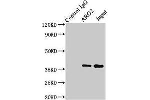 Immunoprecipitating ARG2 in HEK293 whole cell lysate Lane 1: Rabbit control IgG (1 μg) instead of ABIN7144586 in HEK293 whole cell lysate.