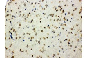 Anti- SHC1 Picoband antibody, IHC(P) IHC(P): Mouse Brain Tissue (SHC1 antibody  (C-Term))