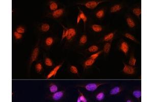Immunofluorescence analysis of U2OS cells using OTUB1 Polyclonal Antibody at dilution of 1:100. (OTUB1 antibody)
