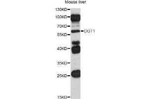 Western blot analysis of extracts of mouse liver, using GGT1 antibody (ABIN5970894) at 1/1000 dilution. (GGT1 antibody)