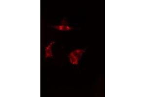 ABIN6277586 staining  HepG2 cells by IF/ICC. (TPT1 antibody  (Internal Region))