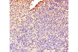 Immunohistochemistry of paraffin-embedded human tonsil tissue using ABIN7150574 at dilution of 1:100 (DOK5 antibody  (AA 1-198))