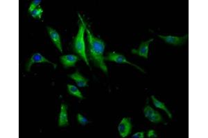 Immunofluorescence staining of U251 cells with ABIN7163572 at 1:133, counter-stained with DAPI. (PEAR1 antibody  (AA 932-1037))