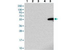 Western blot analysis of Lane 1: RT-4, Lane 2: U-251 MG, Lane 3: Human Plasma, Lane 4: Liver, Lane 5: Tonsil with IGSF11 polyclonal antibody .