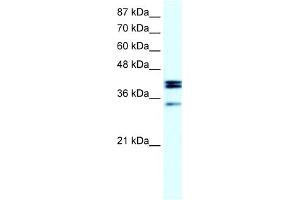 WB Suggested Anti-NR5A1 Antibody Titration:  20ug/ml  Positive Control:  Daudi cell lysate NR5A1 is supported by BioGPS gene expression data to be expressed in Daudi (NR5A1 antibody  (Middle Region))