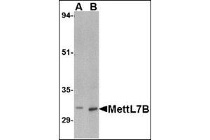 Western blot analysis of MettL7B in rat spleen tissue lysate with MettL7B antibody at (A) 2 and (B) 4 µg/ml