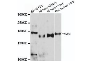 Western blot analysis of extracts of various cell lines, using A2M antibody (ABIN5970754) at 1/500 dilution. (alpha 2 Macroglobulin antibody)