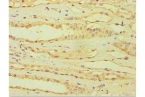 Immunohistochemistry of paraffin-embedded human kidney tissue using ABIN7144871 at dilution of 1:100 (ATP5J antibody  (AA 1-108))