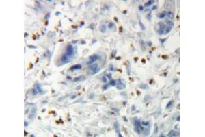 Used in DAB staining on fromalin fixed paraffin-embedded Pancreas tissue (THRB antibody  (AA 239-457))