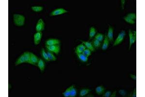 Immunofluorescent analysis of Hela cells using ABIN7175549 at dilution of 1:100 and Alexa Fluor 488-congugated AffiniPure Goat Anti-Rabbit IgG(H+L) (VMO1 antibody  (AA 25-202))