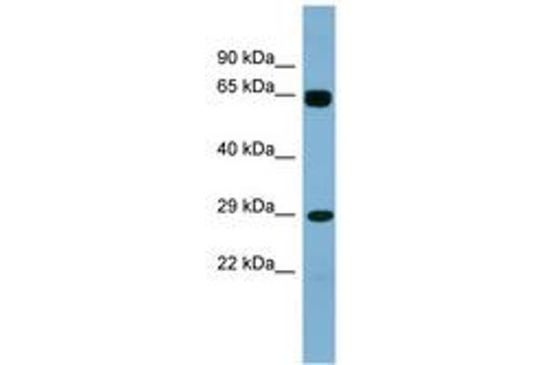 LRRN4CL antibody  (AA 107-156)