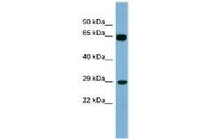 LRRN4CL antibody  (AA 107-156)