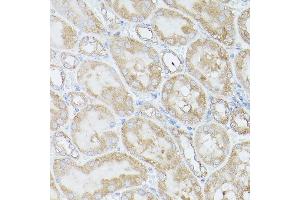 Immunohistochemistry of paraffin-embedded Mouse kidney using RPS18 antibody (ABIN6128660, ABIN6147205, ABIN6147206 and ABIN6215379) at dilution of 1:100 (40x lens). (RPS18 antibody  (AA 1-152))