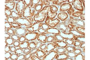 Formalin-fixed, paraffin-embedded human Renal Cell Carcinoma stained with Erythropoietin Mouse Monoclonal Antibody (EPO/1368). (EPO antibody  (AA 28-162))