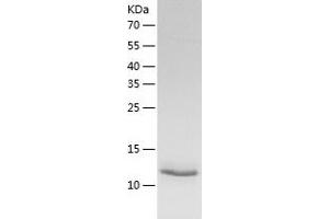 Western Blotting (WB) image for Eukaryotic Translation Initiation Factor 1A, Y-Linked (EIF1AY) (AA 1-144) protein (His tag) (ABIN7122836) (EIF1AY Protein (AA 1-144) (His tag))