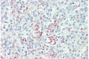 Mannose Receptor antibody  (AA 359-388)