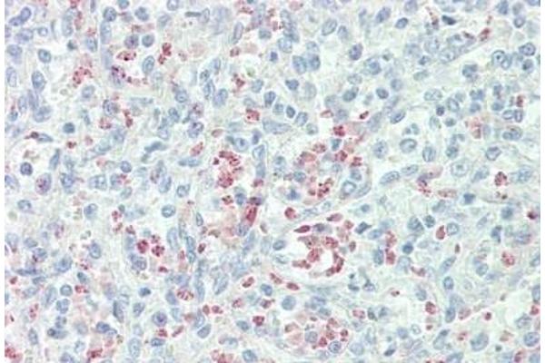 Mannose Receptor antibody  (AA 359-388)