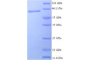 SDS-PAGE (SDS) image for MTB2 (AA 1-360), (full length) protein (His-SUMO Tag) (ABIN5711367)