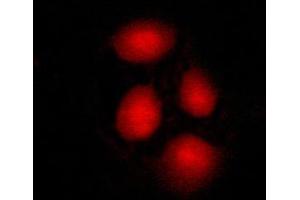 ABIN6269115 staining MCF-7 cells by ICC/IF. (SP1 antibody  (C-Term))