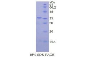 SDS-PAGE (SDS) image for CREB Binding Protein (CREBBP) (AA 2141-2442) protein (His tag) (ABIN2120917)