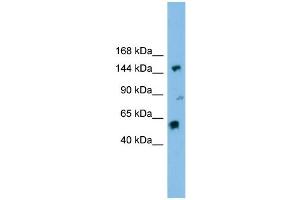 WB Suggested Anti-DHX8 Antibody Titration: 0.