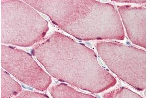 Human Skeletal Muscle: Formalin-Fixed, Paraffin-Embedded (FFPE) (CA3 antibody  (AA 17-46))