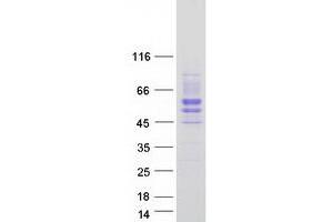 Western Blotting (WB) image for Single Immunoglobulin and Toll-Interleukin 1 Receptor (TIR) Domain (SIGIRR) (Transcript Variant 1) protein (Myc-DYKDDDDK Tag) (ABIN2732048)