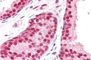ABIN184996 (5µg/ml) staining of paraffin embedded Human Prostate. (GPS1 antibody  (C-Term))