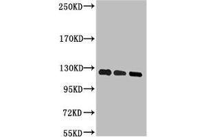 Western blot analysis of 1) Hela, 2) 293T, 3) Jurkat, diluted at 1:2000. (PARP1 antibody)