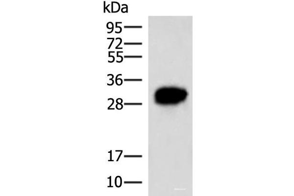 HCCS antibody