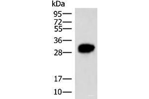Western blot analysis of HepG2 cell lysate using HCCS Polyclonal Antibody at dilution of 1:4000 (HCCS antibody)