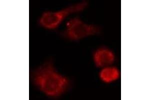 ABIN6277662 staining HuvEc cells by IF/ICC. (LSP1 antibody  (C-Term))