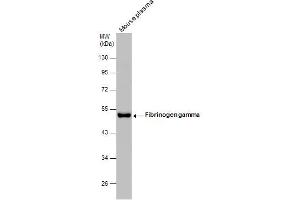 WB Image Mouse tissue extract (50 μg) was separated by 10% SDS-PAGE, and the membrane was blotted with Fibrinogen gamma antibody , diluted at 1:500. (FGG antibody)