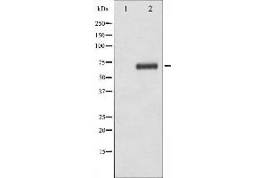 Western Blotting (WB) image for anti-Ribosomal Protein S6 Kinase, 70kDa, Polypeptide 1 (RPS6KB1) (pSer371) antibody (ABIN6256305)