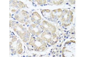 Immunohistochemistry of paraffin-embedded Human stomach using OPA3 Polyclonal Antibody at dilution of 1:100 (40x lens). (OPA3 antibody)