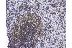IHC analysis of TPR using anti-TPR antibody (ABIN5693275). (TPR antibody)