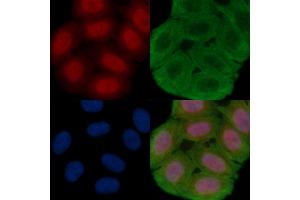 ABIN6261112 and ABIN6277999 staining Hela cells(30 min of UV treatment) by IF/ICC. (Cullin 4B antibody  (N-Term))
