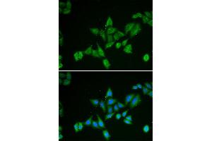 Immunofluorescence (IF) image for anti-BCL2/adenovirus E1B 19kDa Interacting Protein 2 (BNIP2) antibody (ABIN1980298) (BNIP2 antibody)