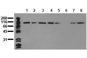 Western Blotting (WB) image for anti-Catenin (Cadherin-Associated Protein), alpha 1, 102kDa (CTNNA1) antibody (ABIN126738) (CTNNA1 antibody)