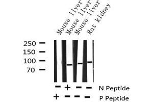 Western blot analysis of Phospho-IKK alpha (Thr23) expression in various lysates (IKK alpha antibody  (pThr23))