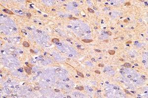Immunohistochemistry analysis of paraffin-embedded mouse brain using,DAK (ABIN7073737) at dilution of 1: 5000