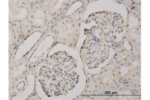 Immunoperoxidase of monoclonal antibody to CSDA on formalin-fixed paraffin-embedded human kidney. (CSDA antibody  (AA 241-330))