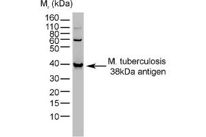 Western Blotting (WB) image for anti-Mycobacterium Tuberculosis (CFP10) antibody (ABIN316622)