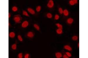 ABIN6268892 staining LOVO by IF/ICC. (FOSL2 antibody  (C-Term))