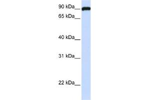 WB Suggested Anti-FAM62C Antibody Titration:  0. (ESYT3 antibody  (N-Term))