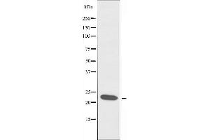 Western blot analysis of extracts from A549 cells, using MRPL13 antibody.
