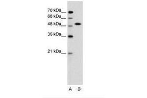 Image no. 1 for anti-SRY (Sex Determining Region Y)-Box 11 (SOX11) (N-Term) antibody (ABIN6736606) (SOX11 antibody  (N-Term))